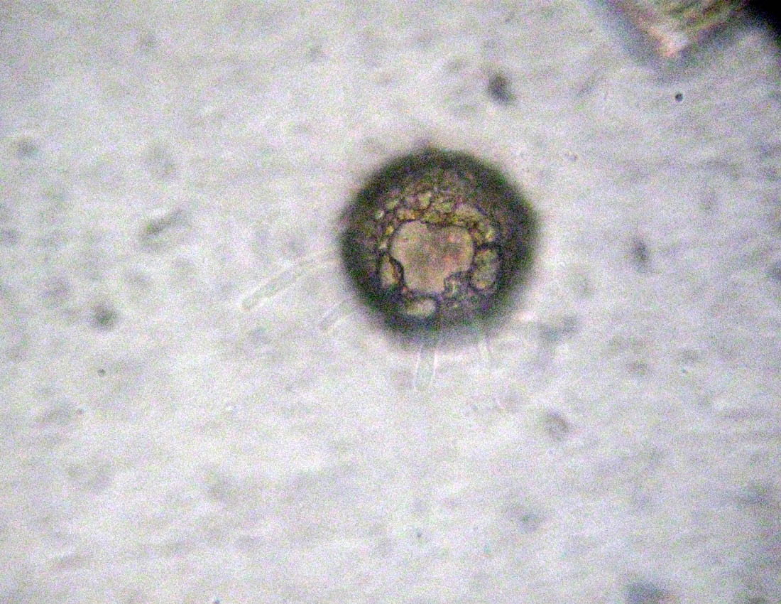 Difflugia verosimilmente gramen